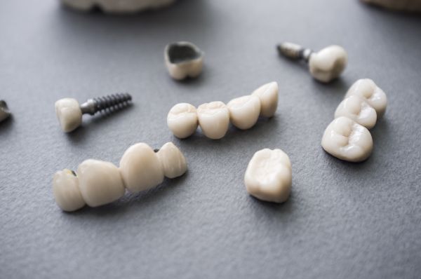 How Long Do Dental Crowns Last?