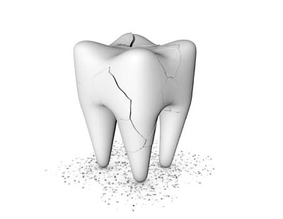 Be Prepared To Answer These Questions From An Emergency Dentist